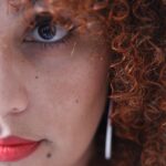 Dicas para melasma