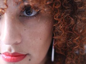 Dicas para melasma
