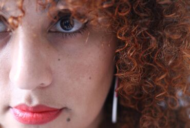 Dicas para melasma